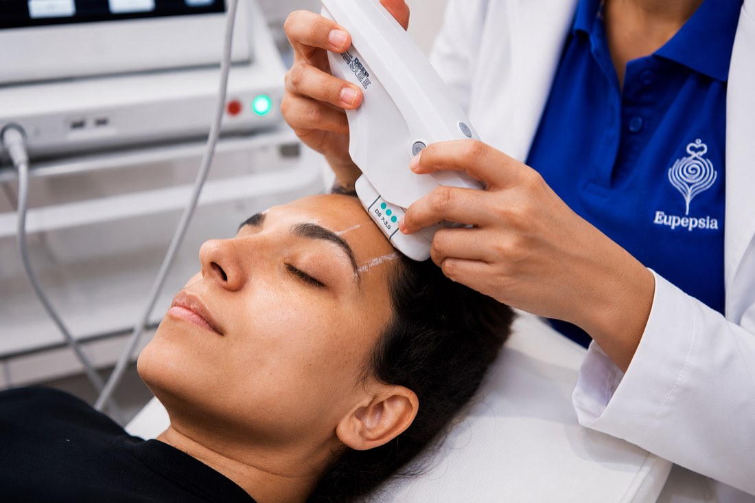 An Ultherapy session in progress